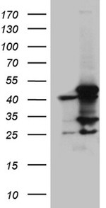 ACADM Antibody in Western Blot (WB)