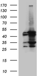 ACADM Antibody in Western Blot (WB)