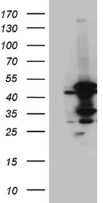 ACADM Antibody in Western Blot (WB)