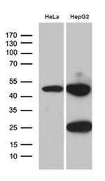 ACADM Antibody in Western Blot (WB)