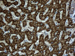 ACADS Antibody in Immunohistochemistry (Paraffin) (IHC (P))