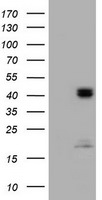 ACADS Antibody in Western Blot (WB)