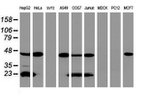 ACADS Antibody in Western Blot (WB)