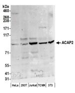 ACAP2 Antibody in Western Blot (WB)