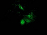 ACAT2 Antibody in Immunocytochemistry (ICC/IF)