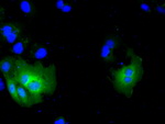 ACAT2 Antibody in Immunocytochemistry (ICC/IF)