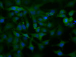 ACAT2 Antibody in Immunocytochemistry (ICC/IF)