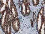 ACAT2 Antibody in Immunohistochemistry (Paraffin) (IHC (P))