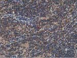 ACAT2 Antibody in Immunohistochemistry (Paraffin) (IHC (P))