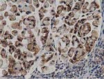 ACAT2 Antibody in Immunohistochemistry (Paraffin) (IHC (P))