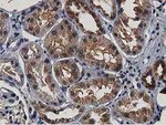 ACAT2 Antibody in Immunohistochemistry (Paraffin) (IHC (P))