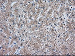 ACAT2 Antibody in Immunohistochemistry (Paraffin) (IHC (P))