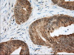 ACAT2 Antibody in Immunohistochemistry (Paraffin) (IHC (P))