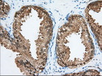 ACAT2 Antibody in Immunohistochemistry (Paraffin) (IHC (P))