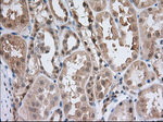 ACAT2 Antibody in Immunohistochemistry (Paraffin) (IHC (P))