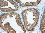 ACAT2 Antibody in Immunohistochemistry (Paraffin) (IHC (P))