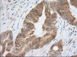 ACAT2 Antibody in Immunohistochemistry (Paraffin) (IHC (P))