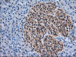 ACAT2 Antibody in Immunohistochemistry (Paraffin) (IHC (P))