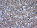 ACAT2 Antibody in Immunohistochemistry (Paraffin) (IHC (P))