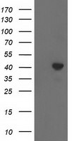 ACAT2 Antibody in Western Blot (WB)