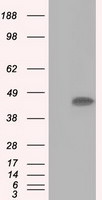 ACAT2 Antibody in Western Blot (WB)