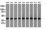 ACAT2 Antibody in Western Blot (WB)