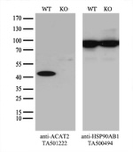 ACAT2 Antibody in Western Blot (WB)