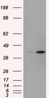 ACAT2 Antibody in Western Blot (WB)