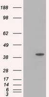 ACAT2 Antibody in Western Blot (WB)