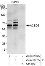 ACBD5 Antibody in Immunoprecipitation (IP)