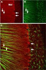 CACNA1A (CaV2.1) Antibody in Immunohistochemistry (IHC)