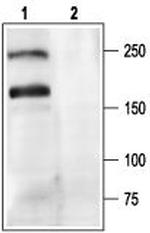 CACNA1A (CaV2.1) Antibody in Western Blot (WB)