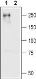 CaV1.2 (CACNA1C) Antibody in Western Blot (WB)