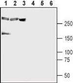 CaV1.3 (CACNA1D) Antibody in Western Blot (WB)