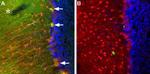 TRPC3 Antibody in Immunohistochemistry (Paraffin) (IHC (P))