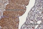 TRPC3 Antibody in Immunohistochemistry (Paraffin) (IHC (P))