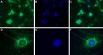 CaV3.2 (CACNA1H) Antibody in Immunocytochemistry (ICC/IF)