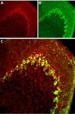 CaV3.2 (CACNA1H) Antibody in Immunohistochemistry (Frozen) (IHC (F))