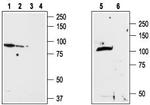 TRPV2 (VRL1) (extracellular) Antibody in Western Blot (WB)