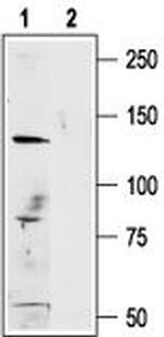 TRPM1 Antibody in Western Blot (WB)