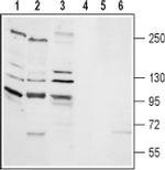 TRPM2 Antibody in Western Blot (WB)