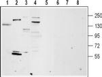 TRPM4 Antibody in Western Blot (WB)