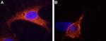 TRPM8 (extracellular) Antibody in Immunocytochemistry (ICC/IF)