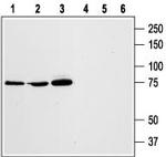 STIM1 (extracellular) Antibody in Western Blot (WB)