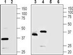 TMEM66 Antibody in Western Blot (WB)