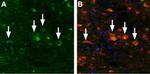 TRPML3 (Mucolipin 3) Antibody in Immunohistochemistry (IHC)