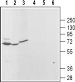 TRPML3 (Mucolipin 3) Antibody in Western Blot (WB)