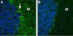 CACNA2D2 (CaV alpha 2 delta 2) (extracellular) Antibody in Immunohistochemistry (IHC)