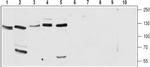 CACNA2D2 (CaV alpha 2 delta 2) (extracellular) Antibody in Western Blot (WB)