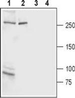 IP3 Receptor-2 (ITPR2) Antibody in Western Blot (WB)